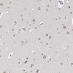 ZNF770 Polyclonal Antibody