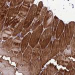 GZF1 Antibody in Immunohistochemistry (Paraffin) (IHC (P))