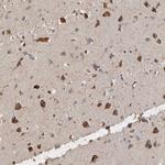 ANKFY1 Polyclonal Antibody