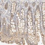 OTOP2 Antibody in Immunohistochemistry (Paraffin) (IHC (P))