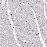 TDRD7 Antibody in Immunohistochemistry (Paraffin) (IHC (P))