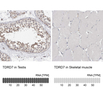 TDRD7 Polyclonal Antibody
