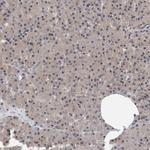 TDRD7 Antibody in Immunohistochemistry (Paraffin) (IHC (P))