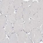 TDRD7 Antibody in Immunohistochemistry (Paraffin) (IHC (P))