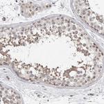 TDRD7 Antibody in Immunohistochemistry (Paraffin) (IHC (P))