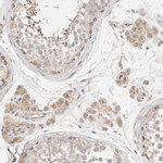 B3GNTL1 Antibody in Immunohistochemistry (Paraffin) (IHC (P))