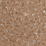 B3GNTL1 Antibody in Immunohistochemistry (Paraffin) (IHC (P))