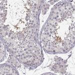 SPATA32 Polyclonal Antibody