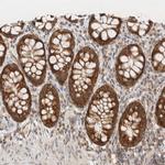 MRPL41 Antibody in Immunohistochemistry (Paraffin) (IHC (P))