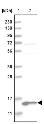 MRPL41 Antibody in Western Blot (WB)