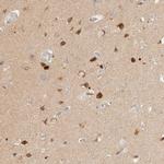 SGSM2 Polyclonal Antibody