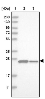 DCTN6 Antibody in Western Blot (WB)