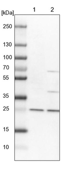 DCTN6 Antibody in Western Blot (WB)