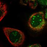 PWP2 Polyclonal Antibody