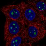 HDHD3 Polyclonal Antibody