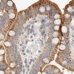 HDHD3 Antibody in Immunohistochemistry (IHC)