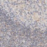 HDHD3 Antibody in Immunohistochemistry (IHC)