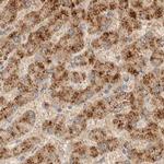 HDHD3 Antibody in Immunohistochemistry (IHC)