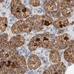 HDHD3 Antibody in Immunohistochemistry (IHC)