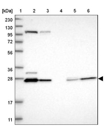 HDHD3 Antibody in Western Blot (WB)