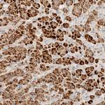 HDHD3 Antibody in Immunohistochemistry (IHC)