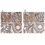 IARS2 Antibody in Immunohistochemistry (Paraffin) (IHC (P))