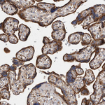 IARS2 Antibody in Immunohistochemistry (Paraffin) (IHC (P))
