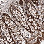 IARS2 Antibody in Immunohistochemistry (Paraffin) (IHC (P))