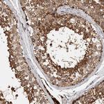 IARS2 Antibody in Immunohistochemistry (Paraffin) (IHC (P))