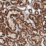 IARS2 Antibody in Immunohistochemistry (Paraffin) (IHC (P))