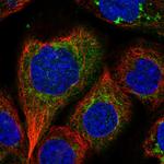 IARS2 Polyclonal Antibody