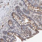IARS2 Antibody in Immunohistochemistry (Paraffin) (IHC (P))
