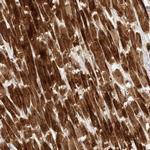 KIF1C Antibody in Immunohistochemistry (IHC)