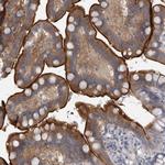 ENPP7 Polyclonal Antibody