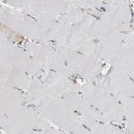 FAM83H Antibody in Immunohistochemistry (IHC)