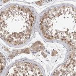 ZNF341 Antibody in Immunohistochemistry (IHC)
