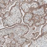 GREB1 Antibody in Immunohistochemistry (IHC)