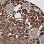 GREB1 Antibody in Immunohistochemistry (IHC)