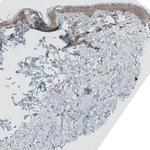 GREB1 Antibody in Immunohistochemistry (IHC)