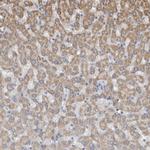 GREB1 Antibody in Immunohistochemistry (IHC)