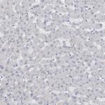 ADAM2 Antibody in Immunohistochemistry (IHC)