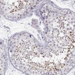 KLF17 Antibody in Immunohistochemistry (IHC)