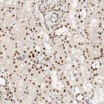 ZNF768 Polyclonal Antibody