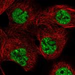 TRBP1 Polyclonal Antibody