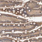 TRBP1 Antibody in Immunohistochemistry (Paraffin) (IHC (P))