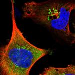 SAMD12 Polyclonal Antibody