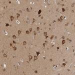 SAMD12 Antibody in Immunohistochemistry (Paraffin) (IHC (P))