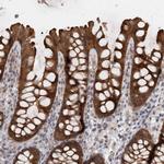 SAMD12 Antibody in Immunohistochemistry (Paraffin) (IHC (P))