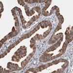 SAMD12 Antibody in Immunohistochemistry (Paraffin) (IHC (P))