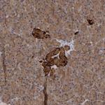 SAMD12 Antibody in Immunohistochemistry (Paraffin) (IHC (P))